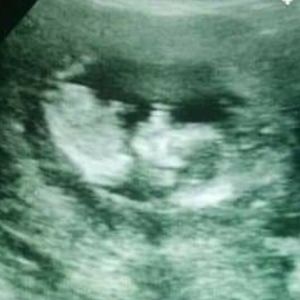 Meet your Posher, Malik